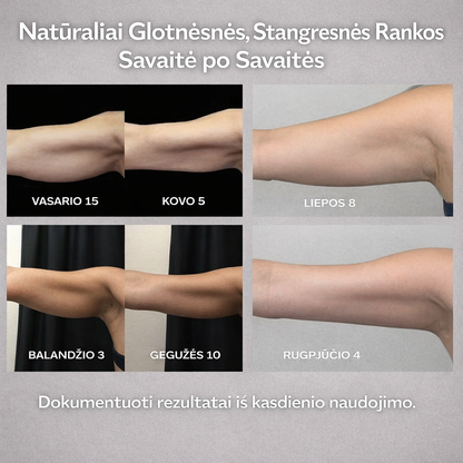 Formuojančios Kompresinės Rankovės